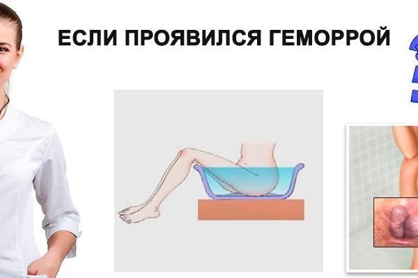 Какая ссылка у кракена